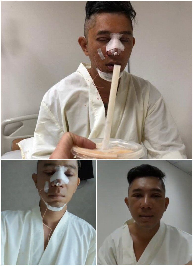 Lương Bằng Quang trước khi chi 100 triệu "đập mặt xây lại" với Ngân 98 - 8