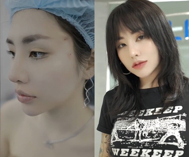 Tình cũ Đạt G hiện tại: Nhan sắc lạ lẫm hậu &#34;dao kéo&#34;, mặc khoét hở tận hông khoe body nóng bỏng - 2