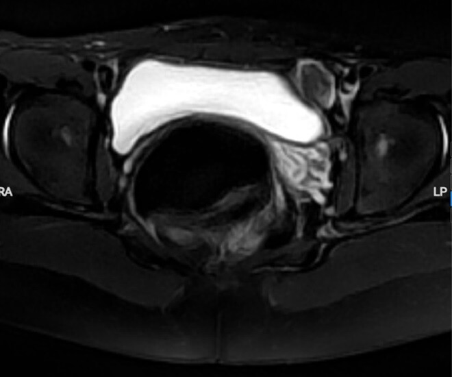 Cô gái đi khám khi 17 tuổi vẫn chưa dậy thì, cả gia đình bàng hoàng khi biết là nam giới - 1
