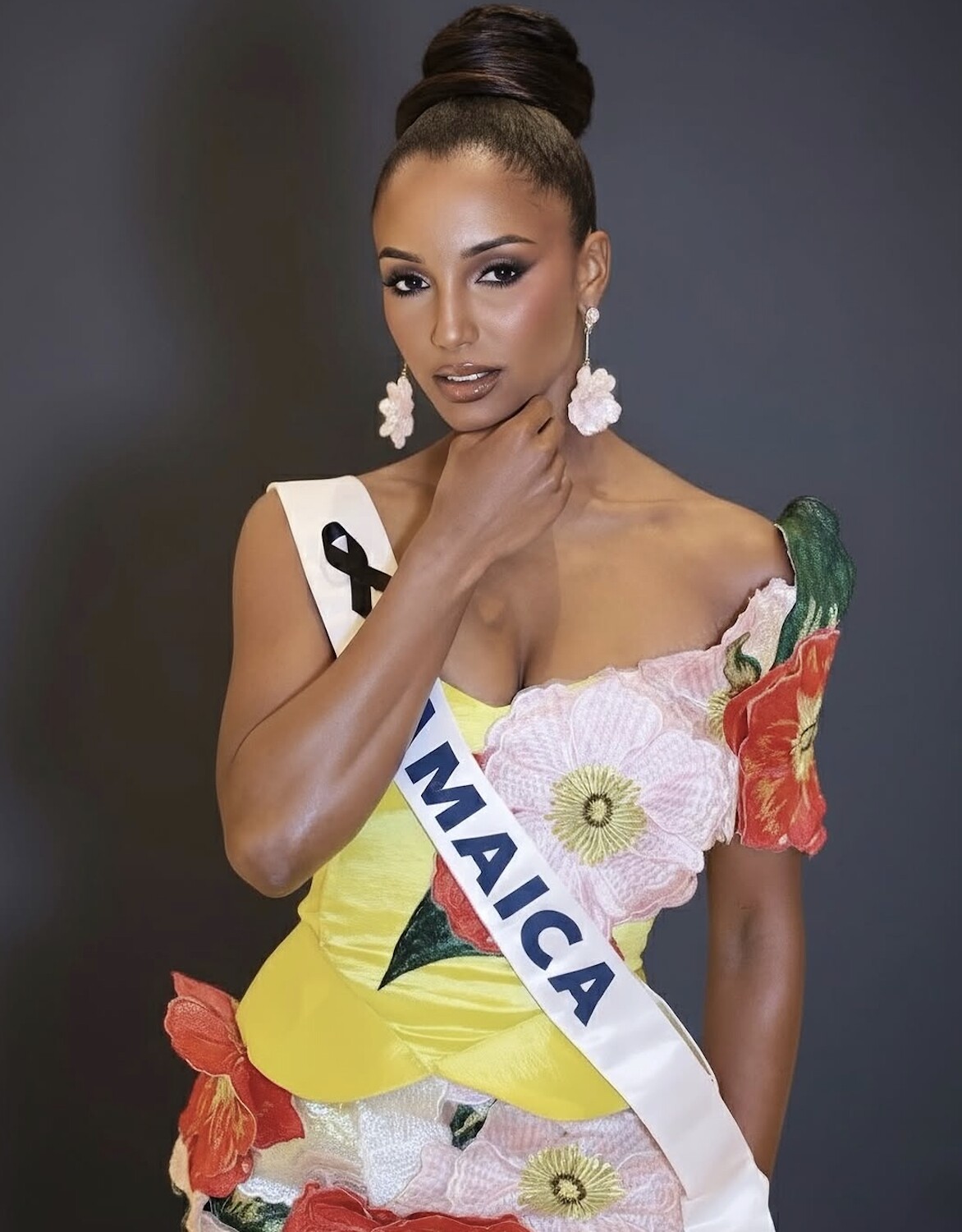 Đối thủ của Hương Giang trượt ngã trên sân khấu Miss Universe, phải rời đi bằng cáng: Tình trạng hiện tại thế nào?  - 3